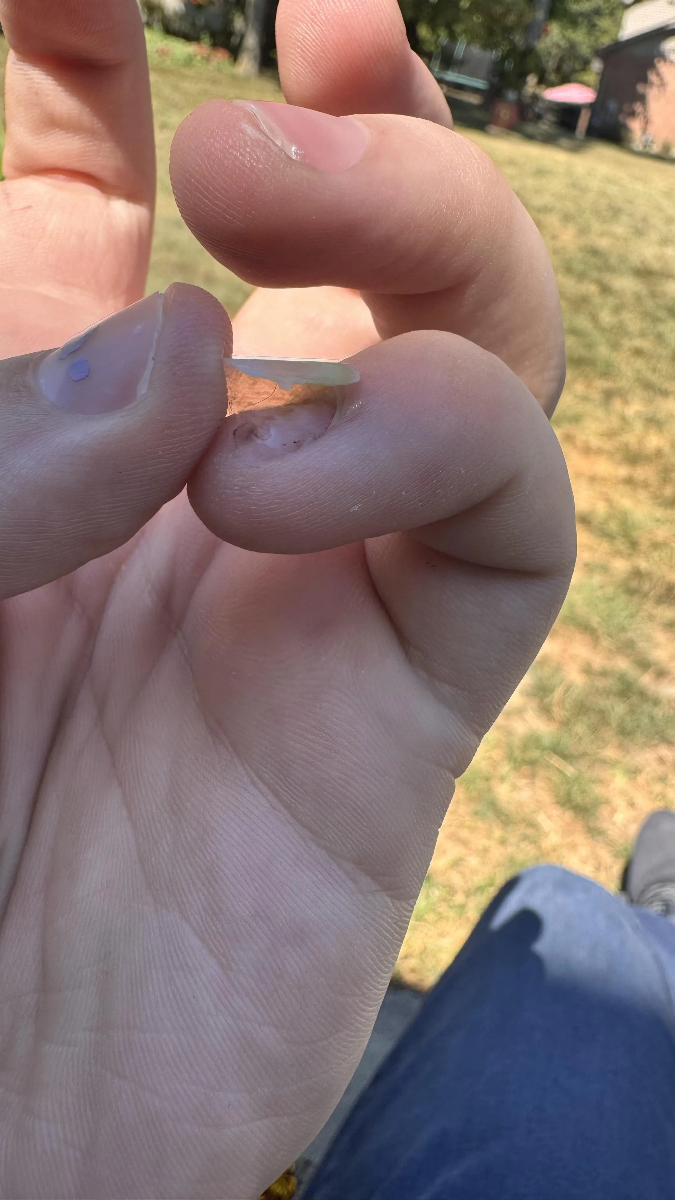 I jammed my nail in a door two months ago. Now it’s all coming off.