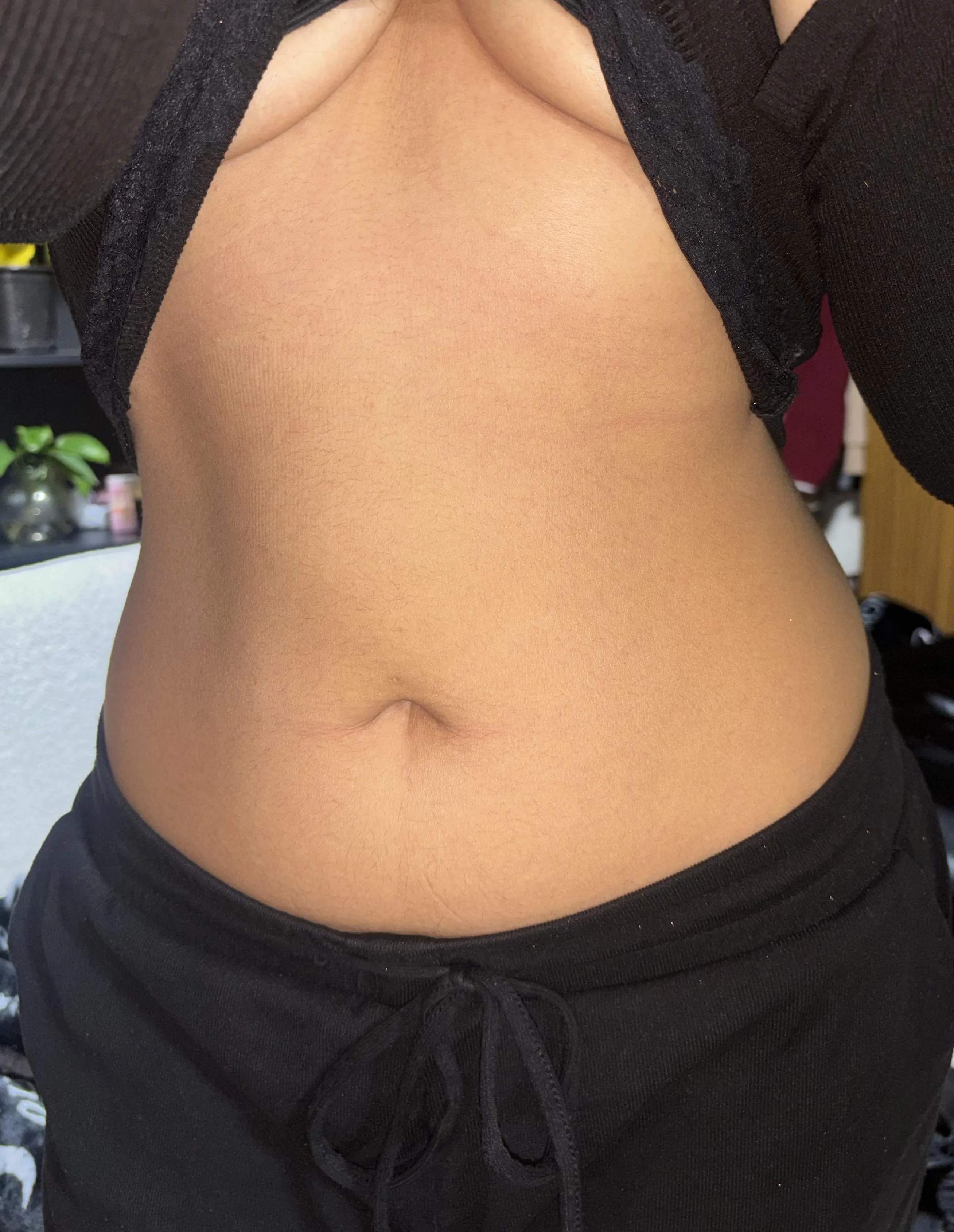 Peach fuzz tummy pic