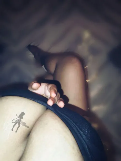 People may like my body but I hate my stretch marks.