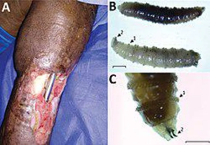 Wound aftermath from a screwworm infection, a species of flesh eating fly thats approaching the United States boarded.