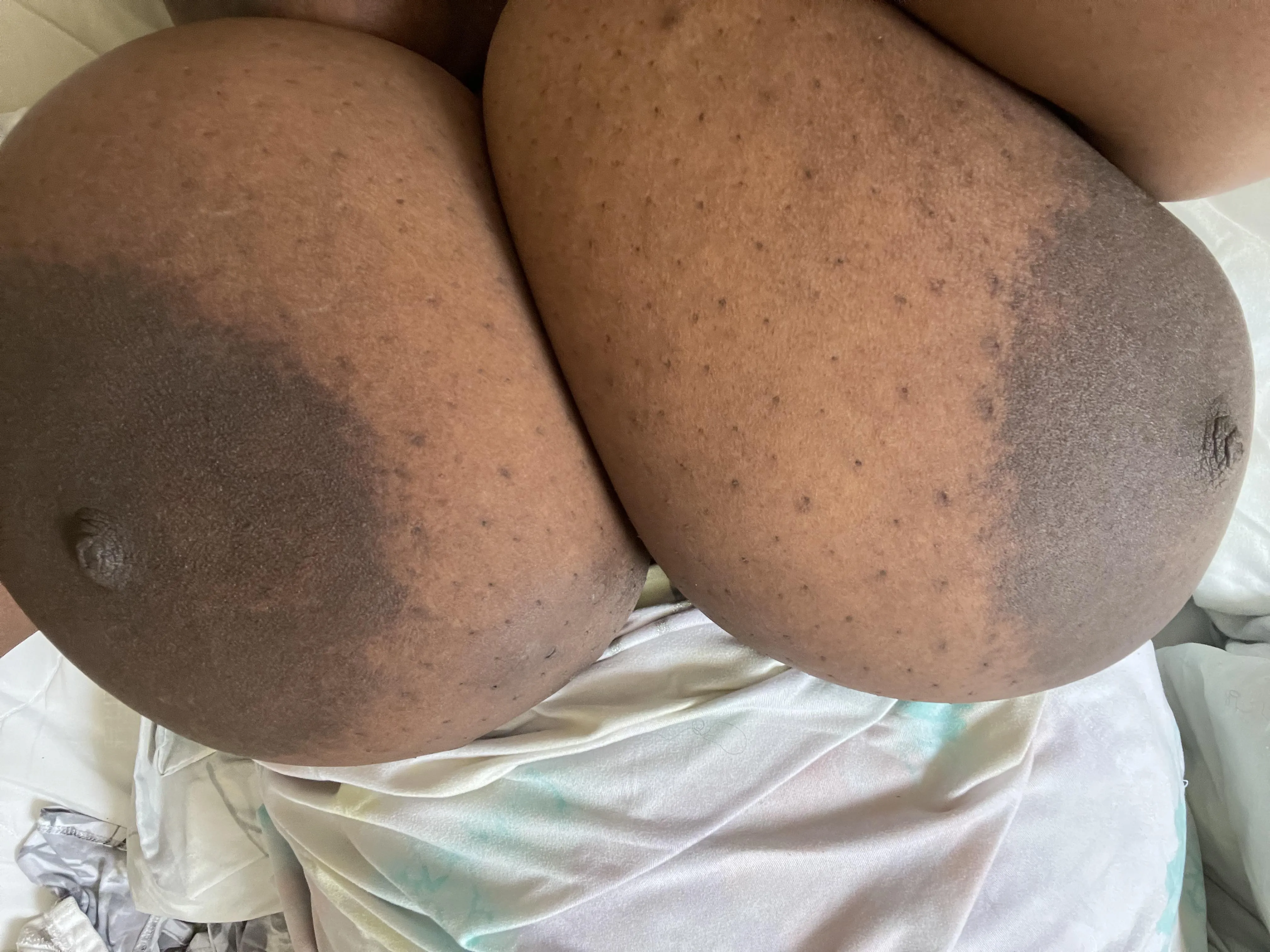 31 F4M Do you like big areolas