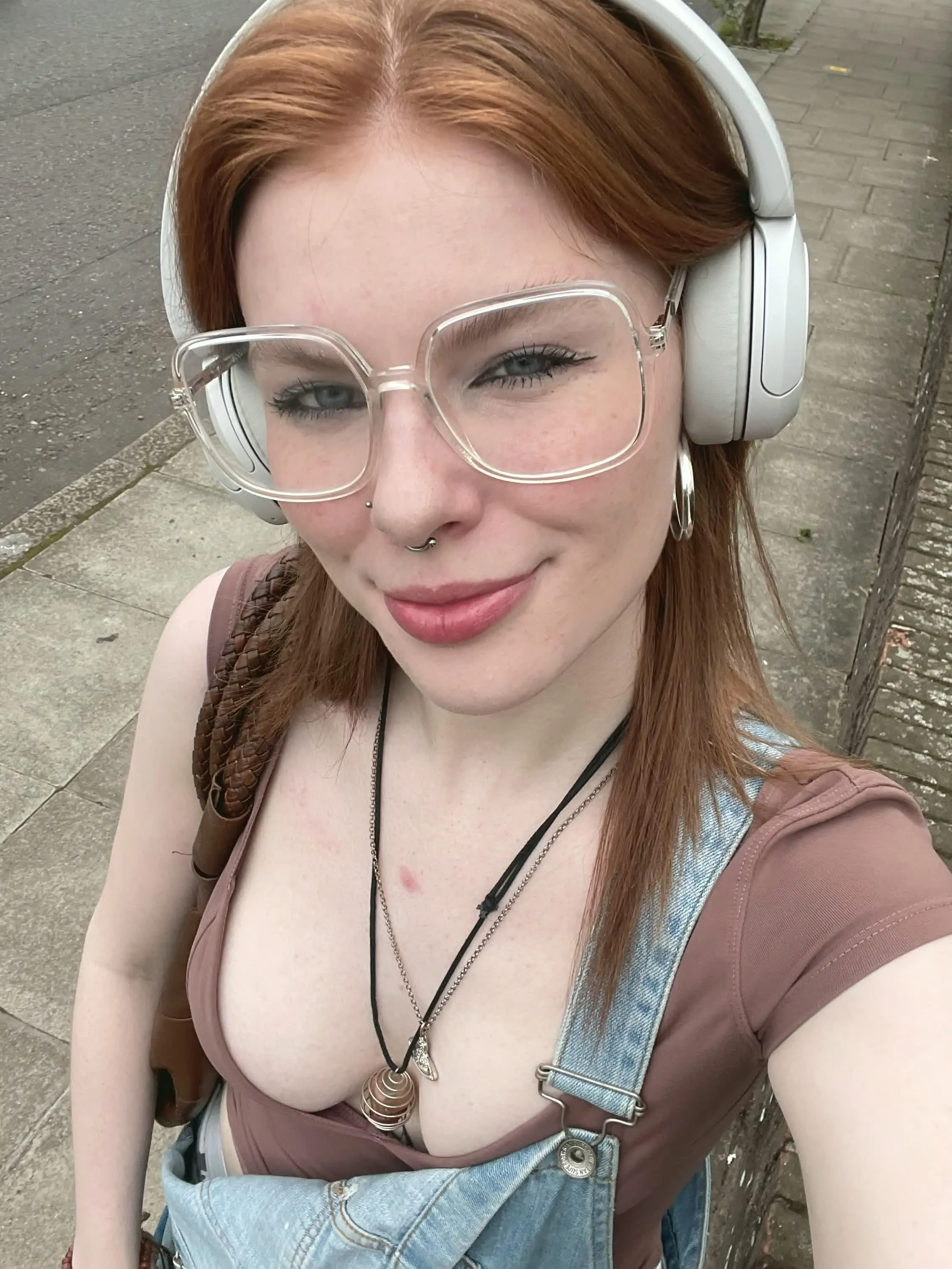 freckled or nahh [IRTR]