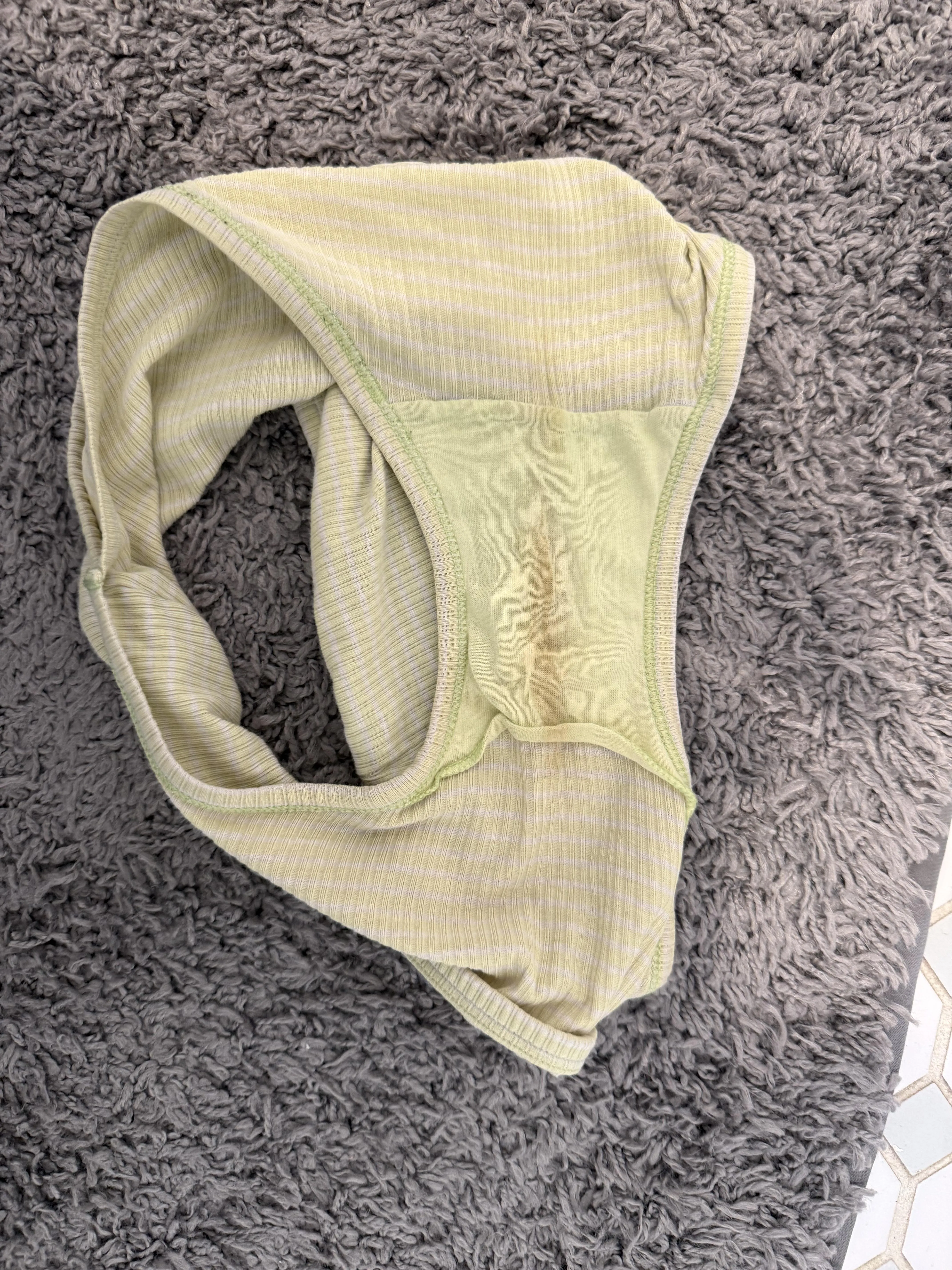 Love her little brown stink stains on them