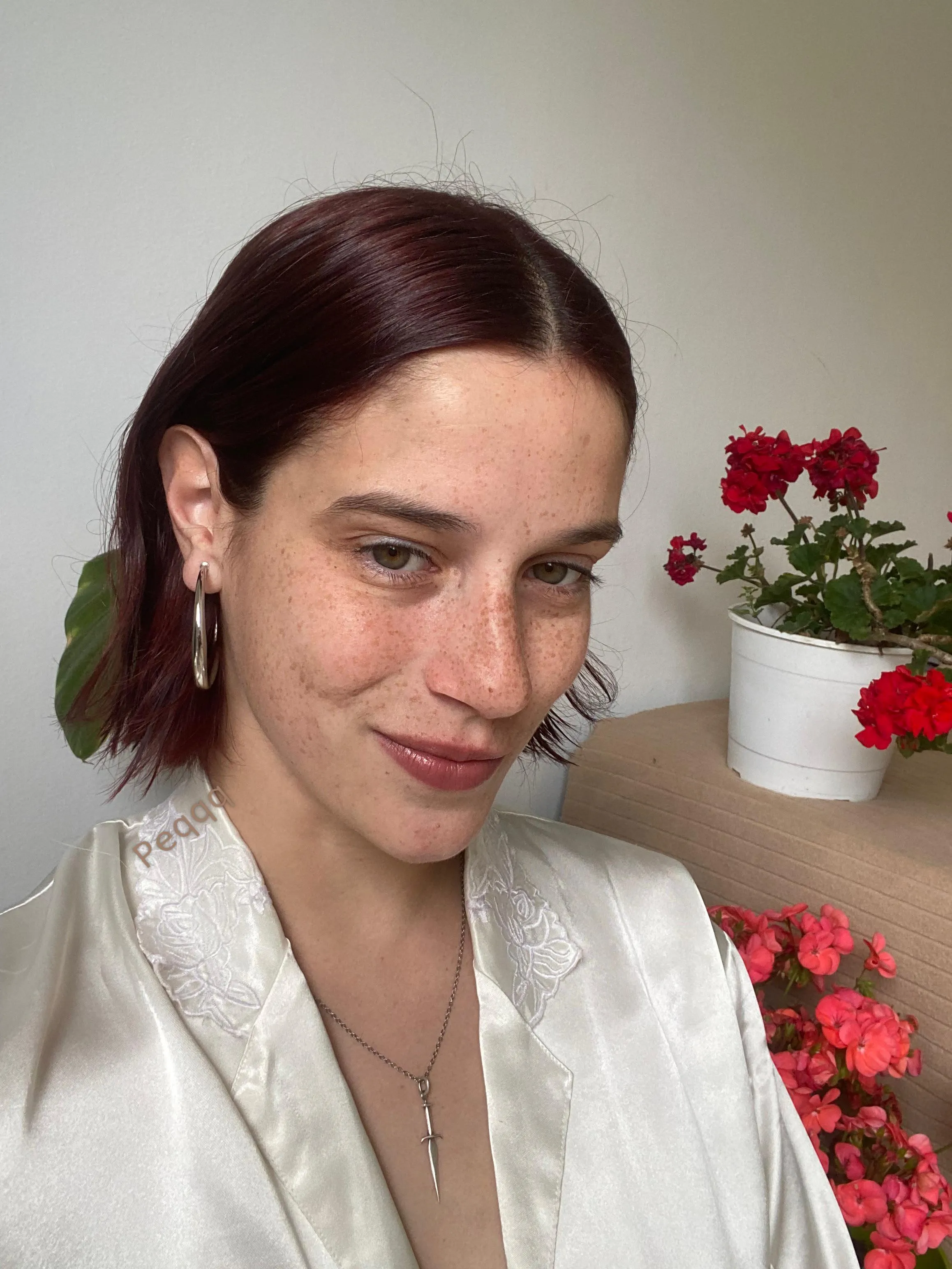 Its spring and freckles are popping up