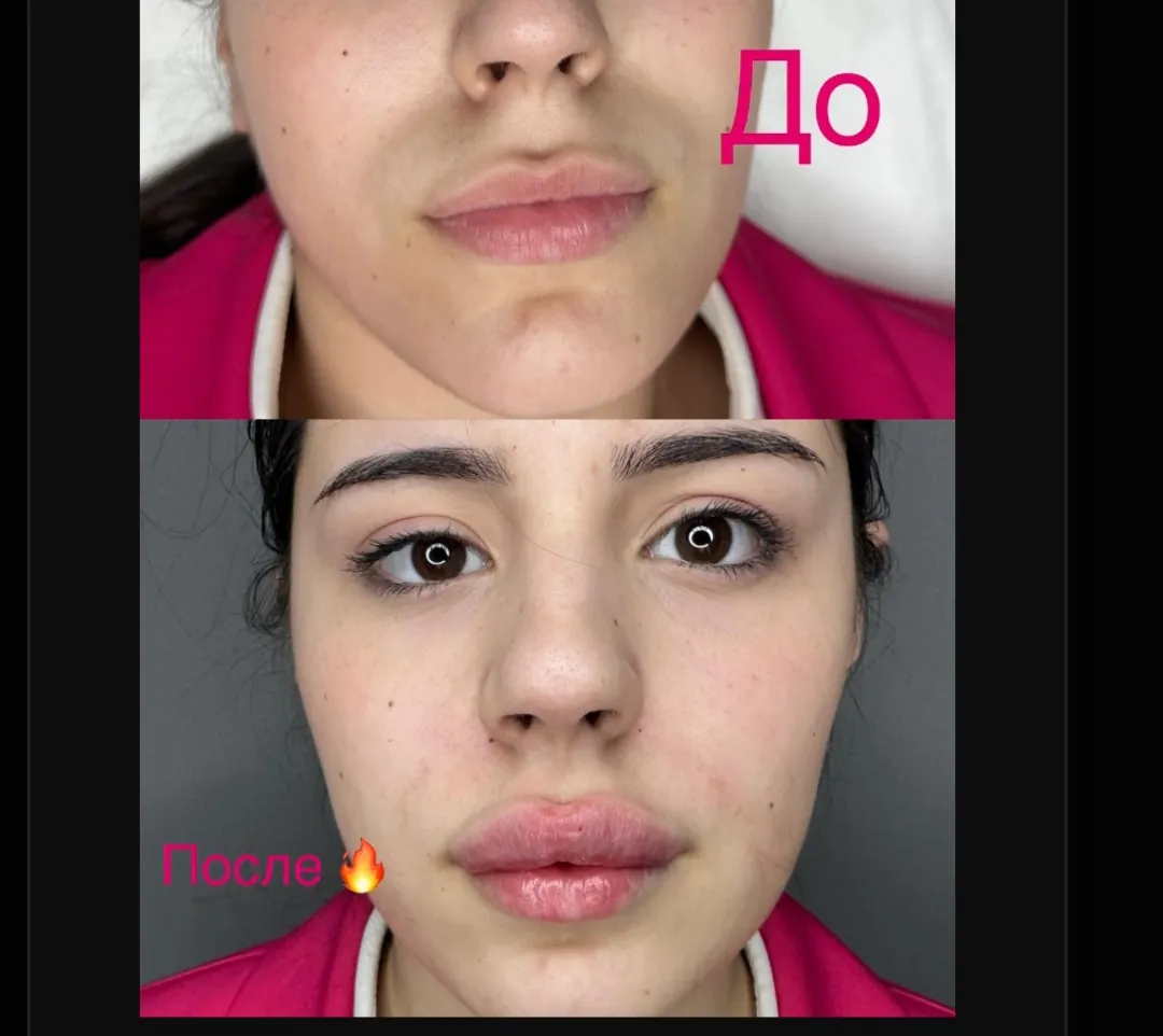 Least dangerous procedure in eastern europe.