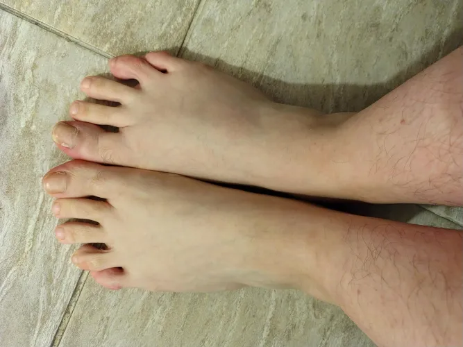 Do you want to see more of my ugly feet? tlegm andfe1