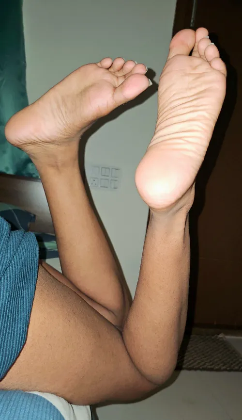 They need some thick warm moisturizer