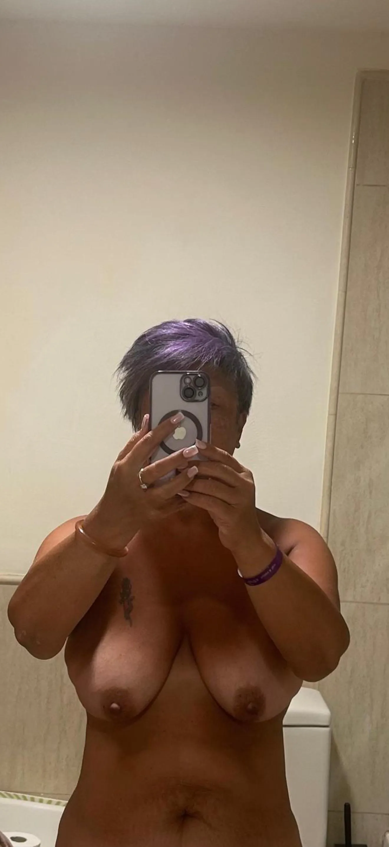 White bits after sun bathing while holiday in Tenerife