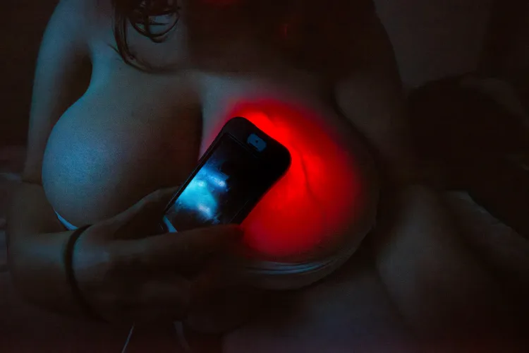 Check my veins from a 8 years ago X