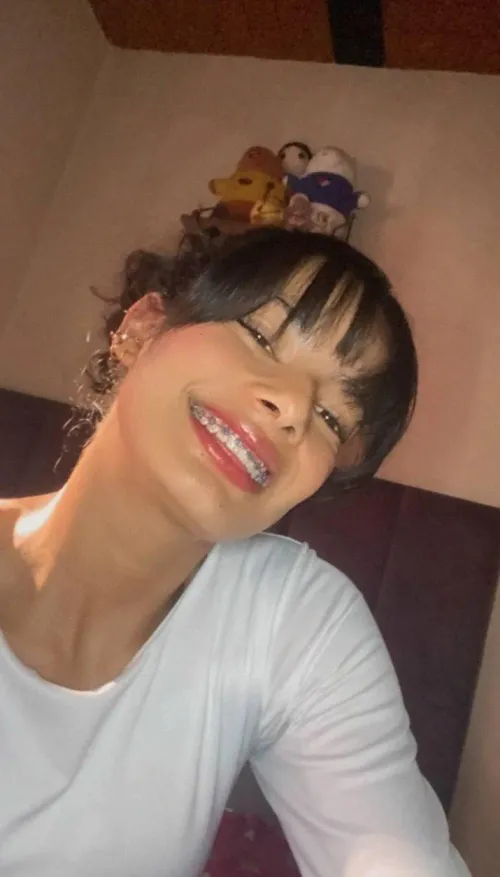 I am aware that in your heart you want to bring me into a pitch-black room and put my braces on