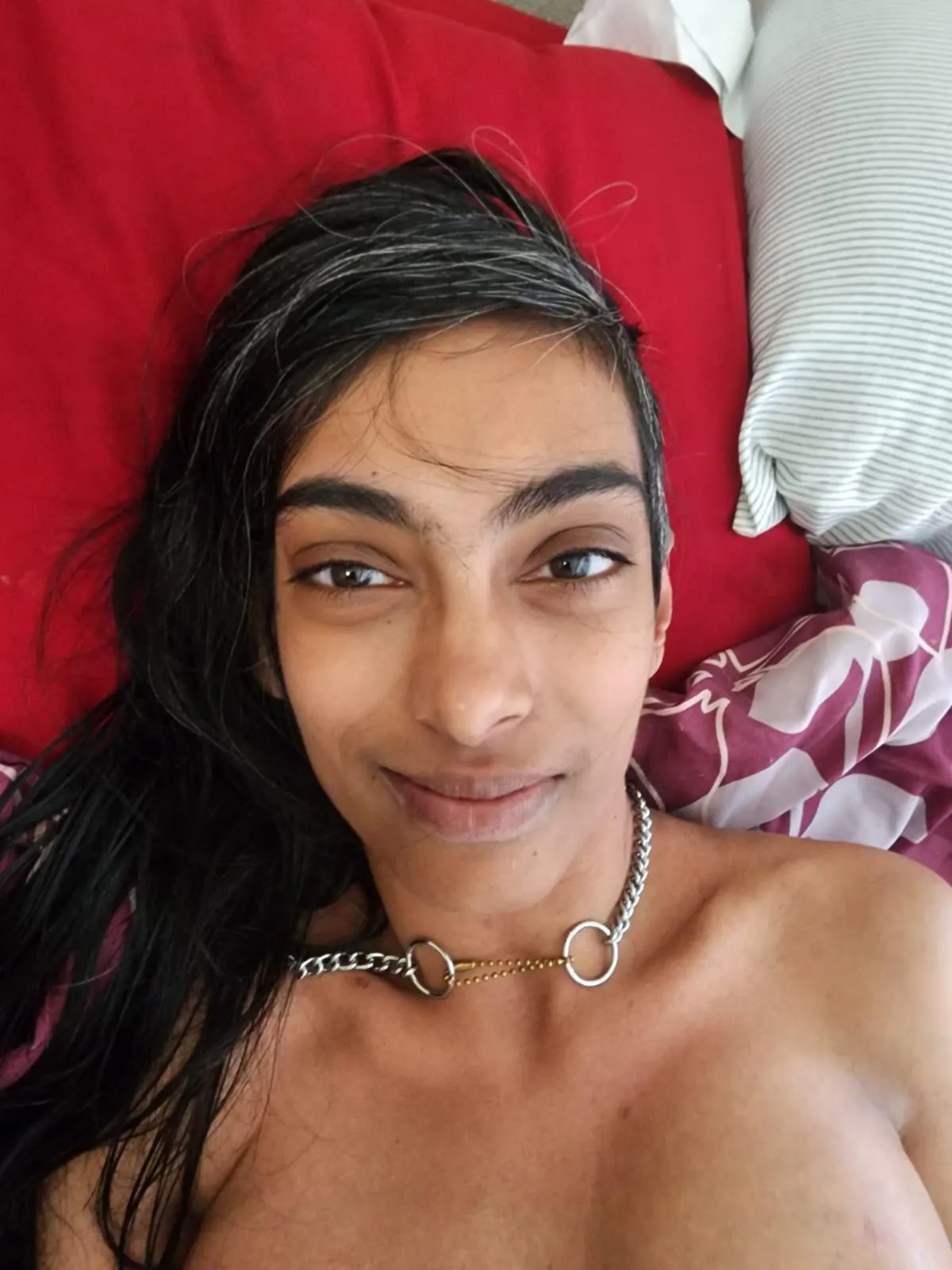 Cerebral Palsy and Scoliosis