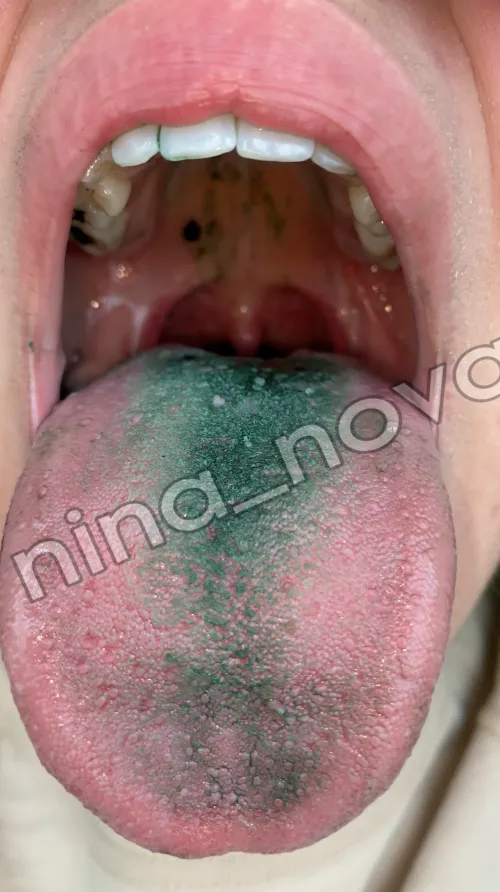 Beeing swallowed by a green princes is a great honor {f}