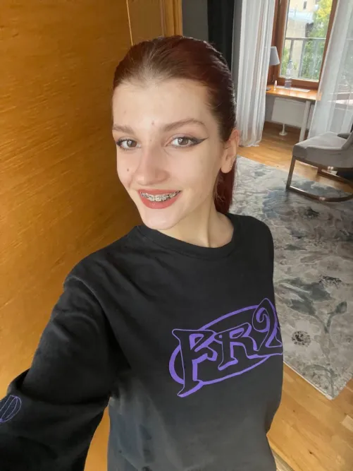 rate my braced smile