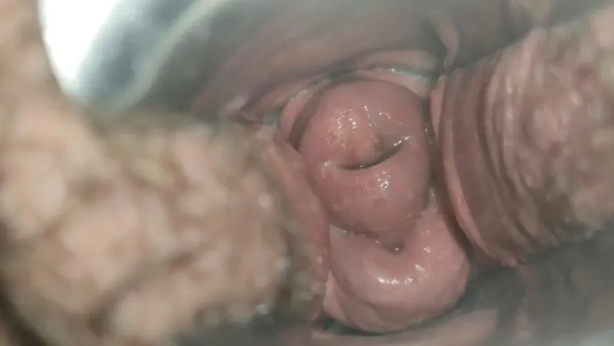 I can't get enough of being this open... [FTM]