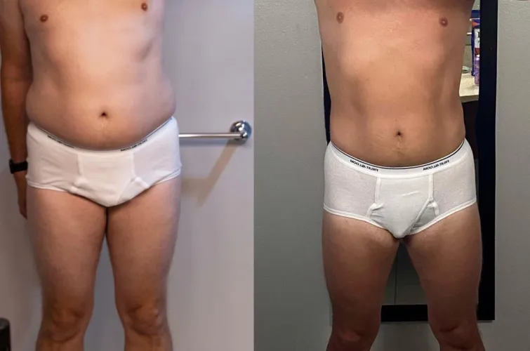 This is why it’s important to get your T levels right