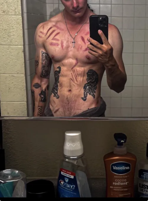 Last picture I used was outdated, but scars can be hot I think🖤