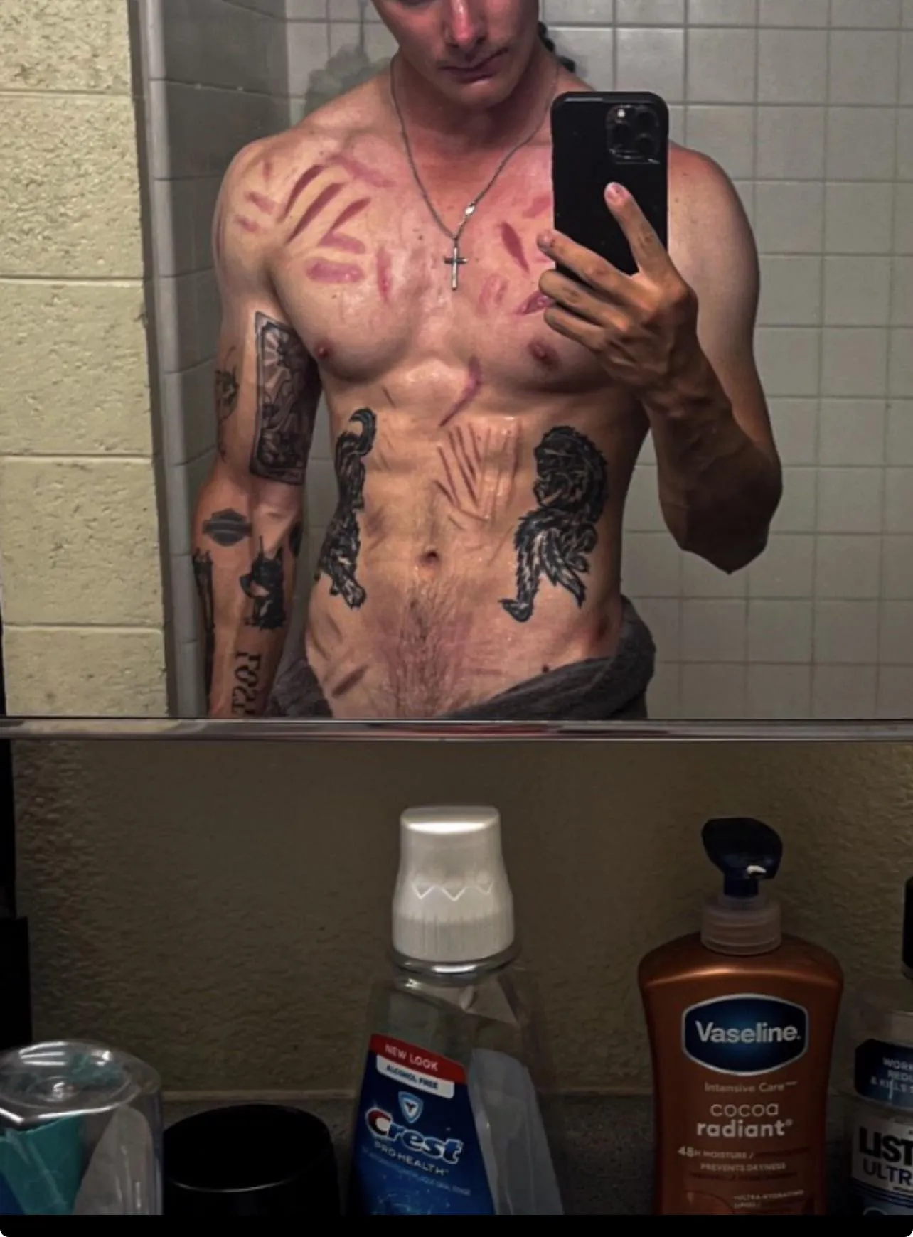 Last picture I used was outdated, but scars can be hot I think🖤