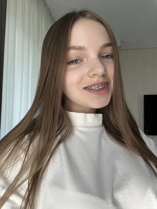 Am I sexy with braces