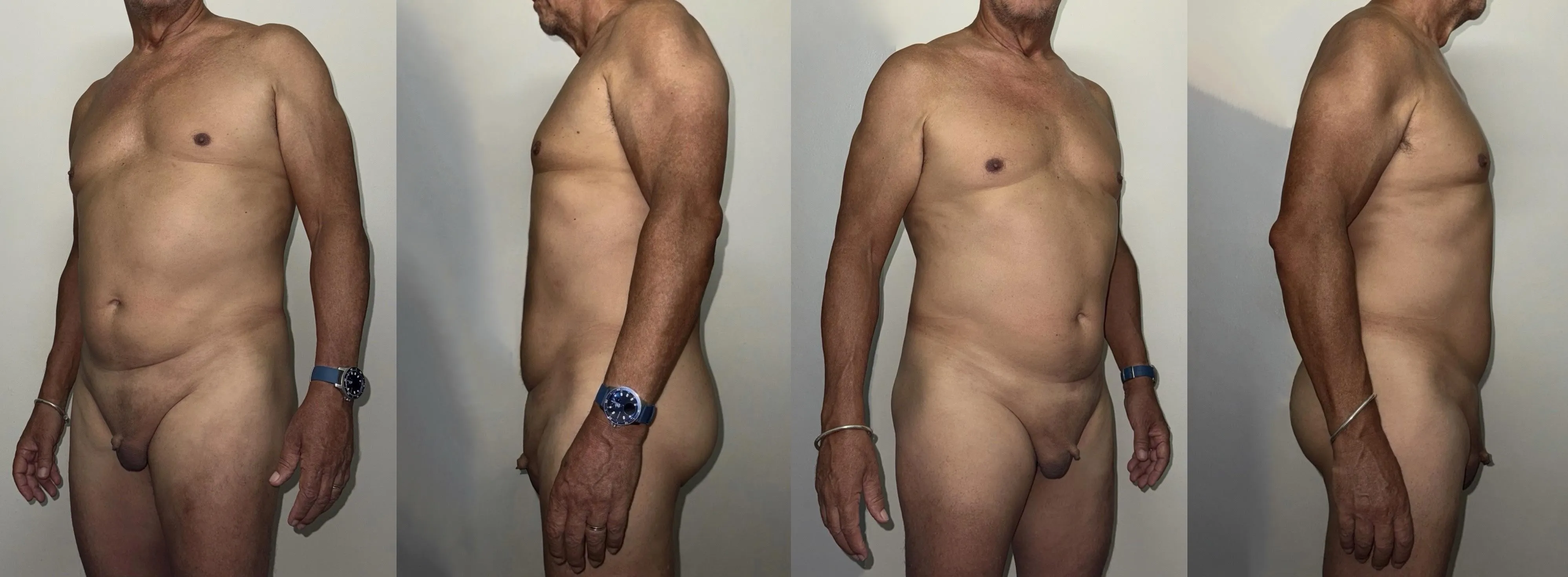 Here, in a semi-erect state, can we call it a penis?