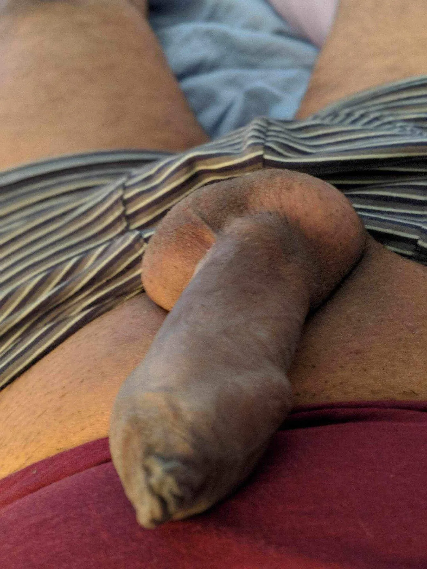 My Uncut Phomosis Cock