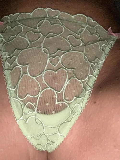 Did you find the freckle ?