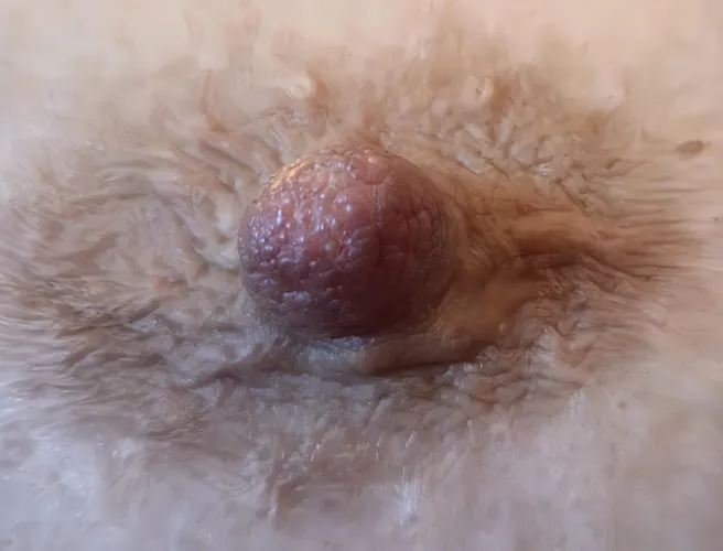 This could be the most zoomed in wrinkled nipple posted here