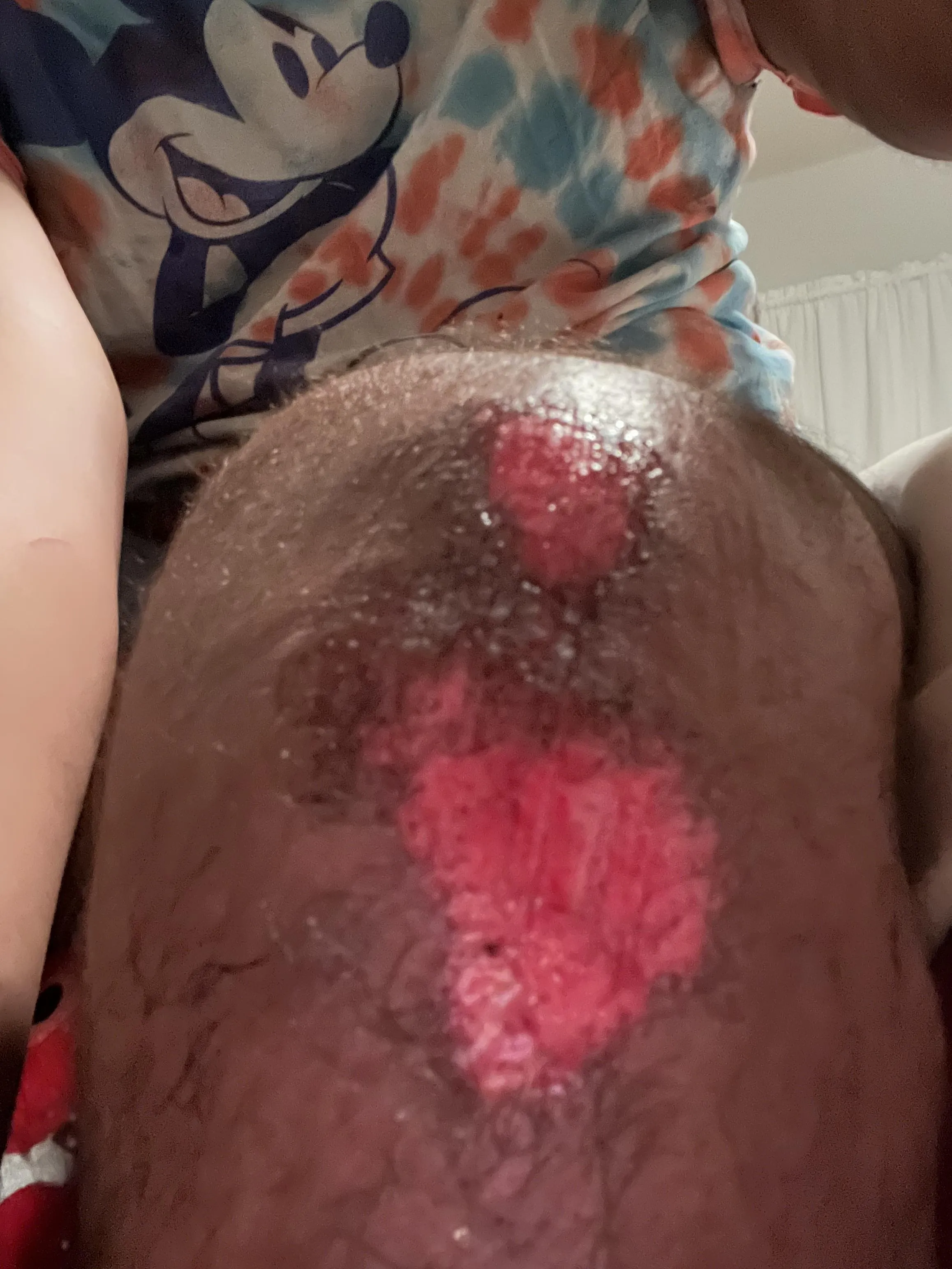 Broke my damn Kneecap. First shower was lit.