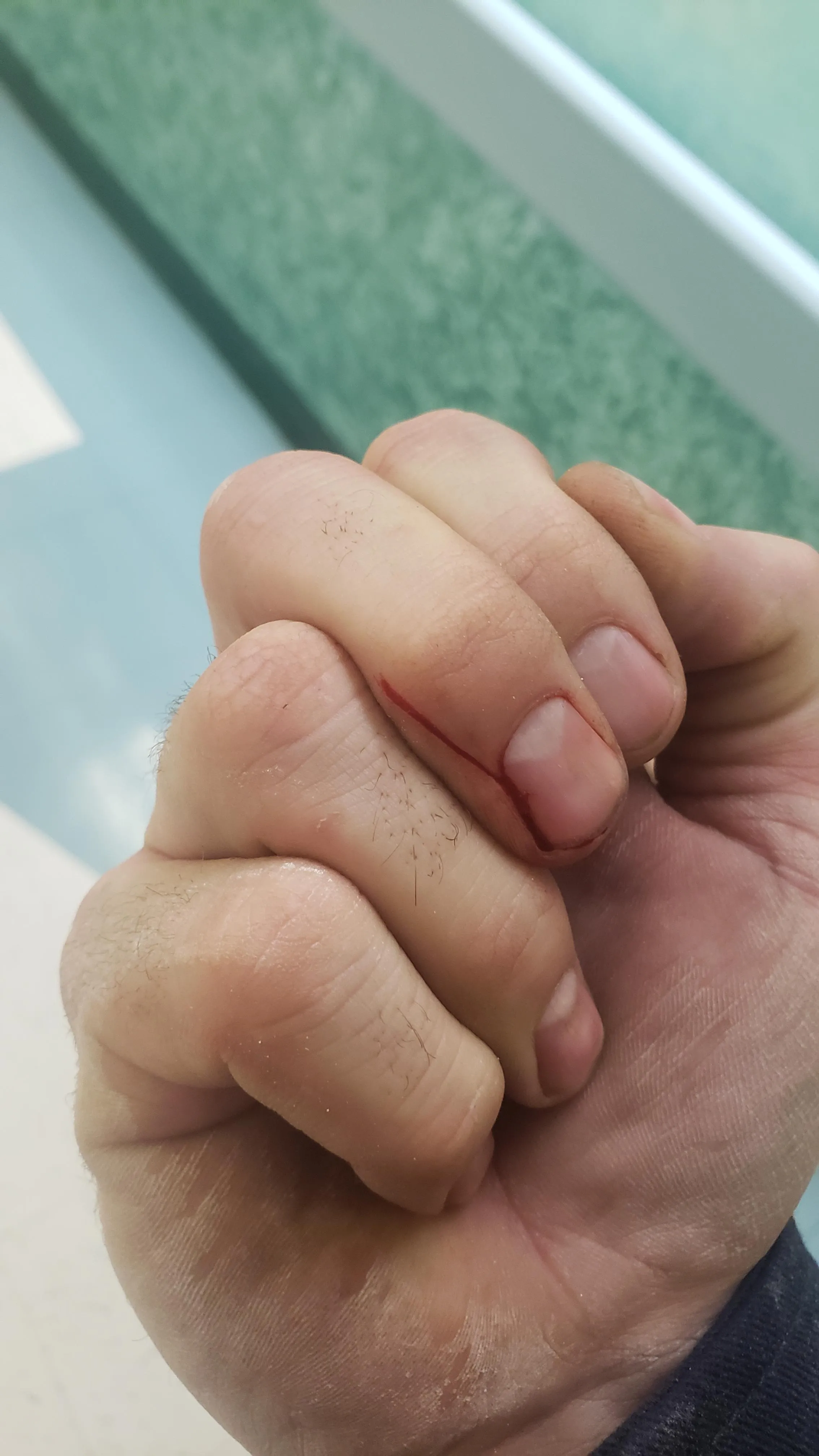 Throwback to when I pulled a little too hard