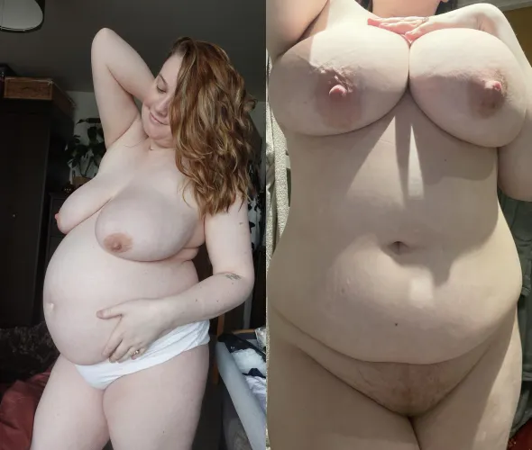 Pregnancy vs postpartum