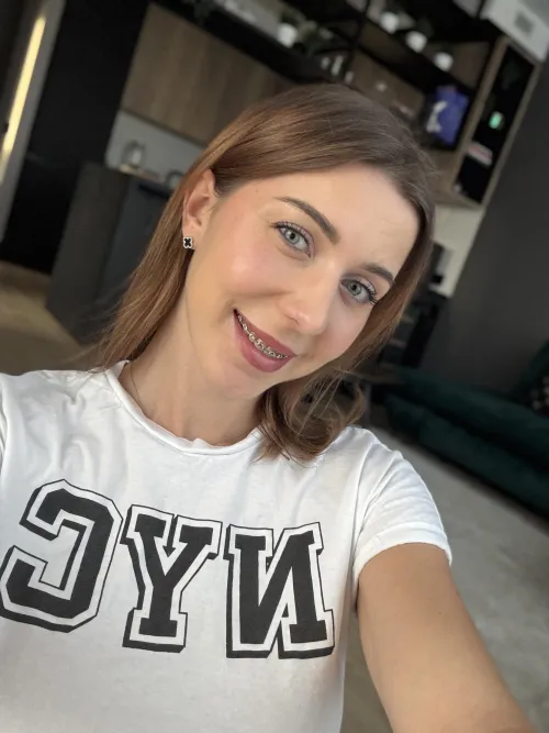 Do you find me attractive with braces?