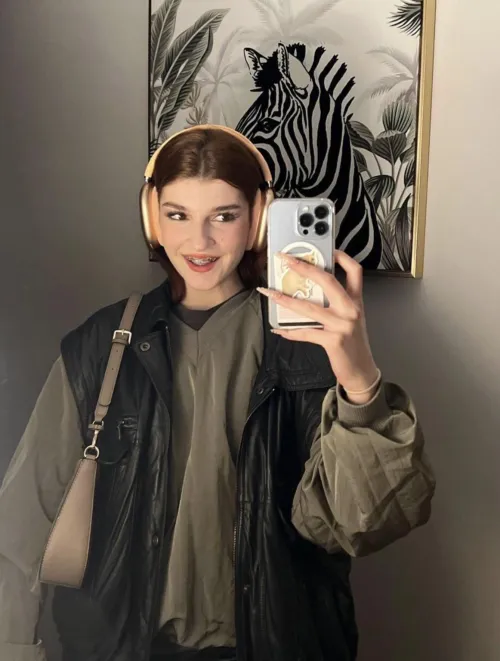 hot or nah with these braces?