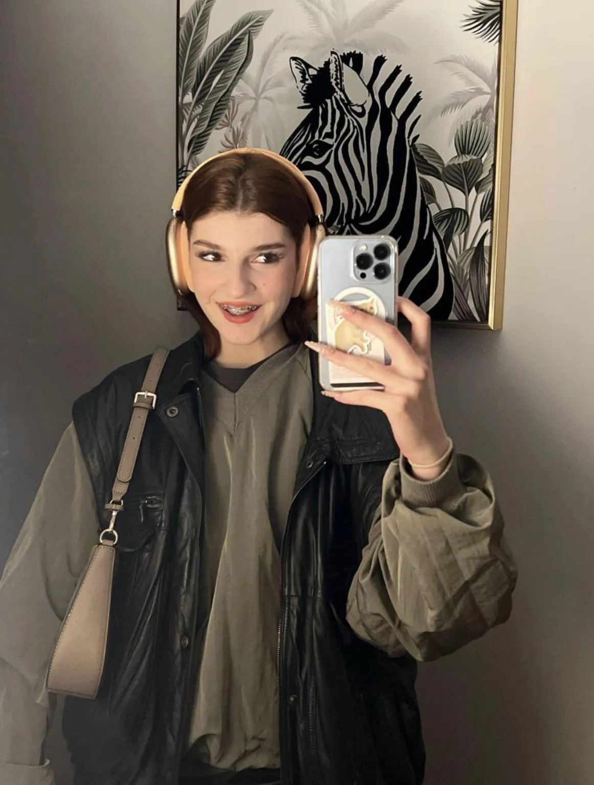 hot or nah with these braces?