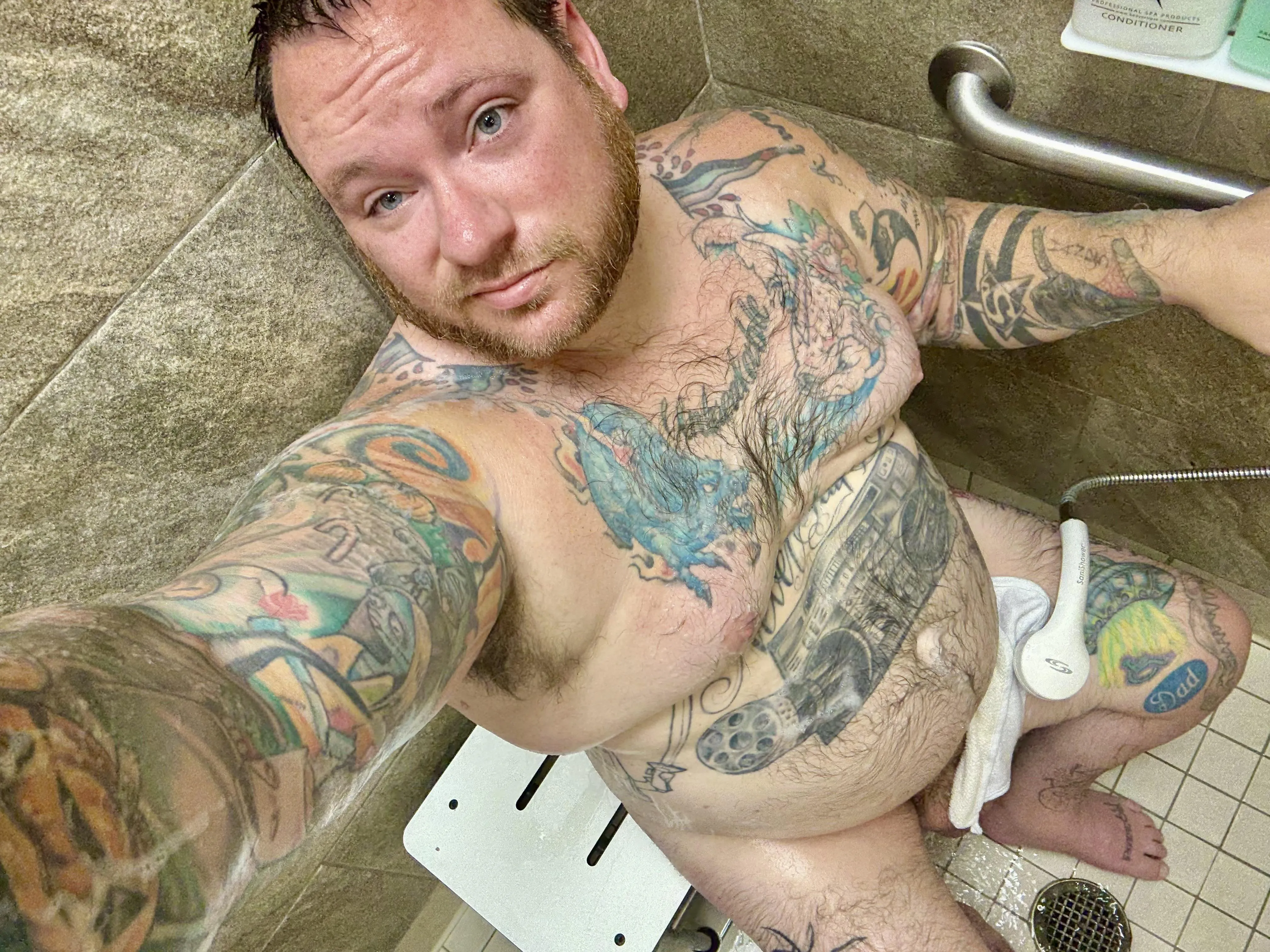 M39 Spinal Cord Injury, Any Takers?