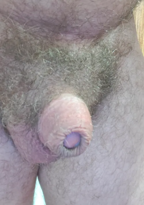 10 min after removing my CAR-1