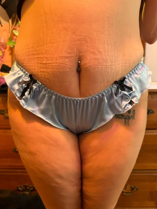 Stretch marks and cellulite - my flaws tell a story