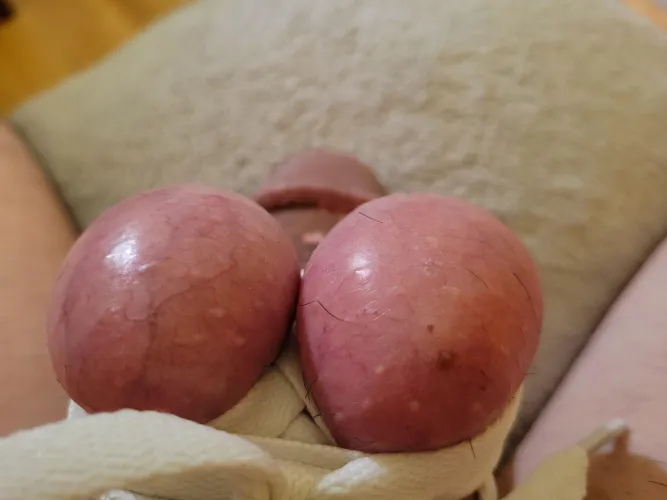 Balls bound painfully on top