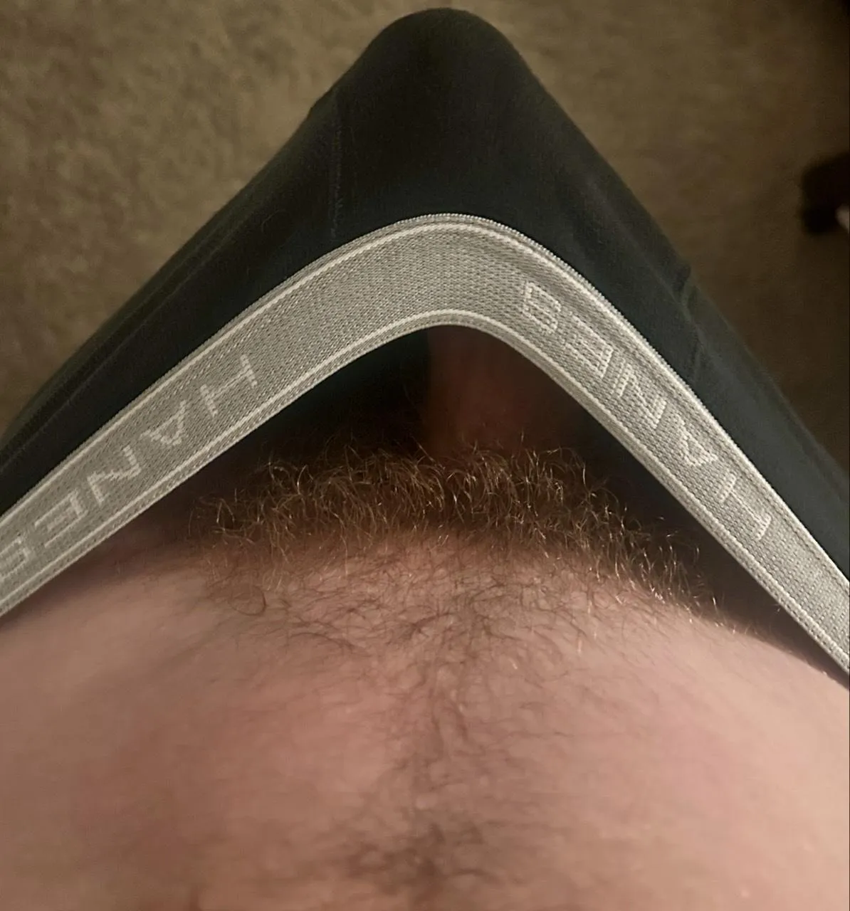 My cock might be too big for my underwear [18]