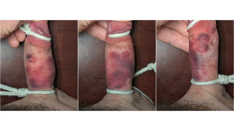 cum on my abused cock?