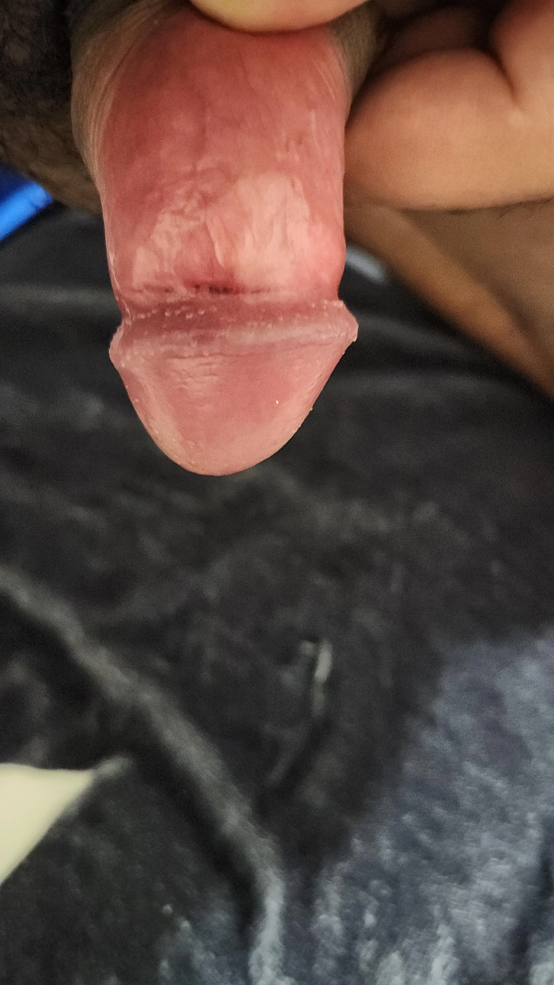 Discoloration underneath head after girth work