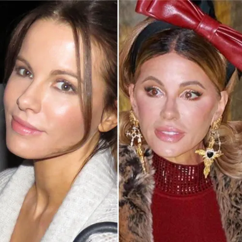 And she still denies having any cosmetic procedures.