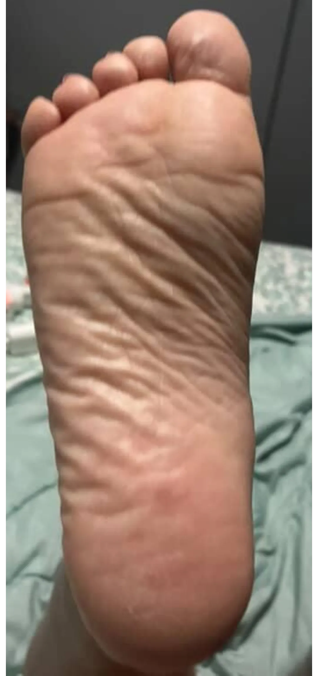 Congratulations! My wrinkly soles are out and You're on wrinkle counting duty.