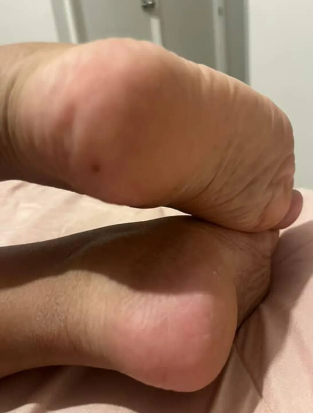 These heels need moisturizing. How would you help me