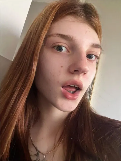 would you kiss a girl with braces?