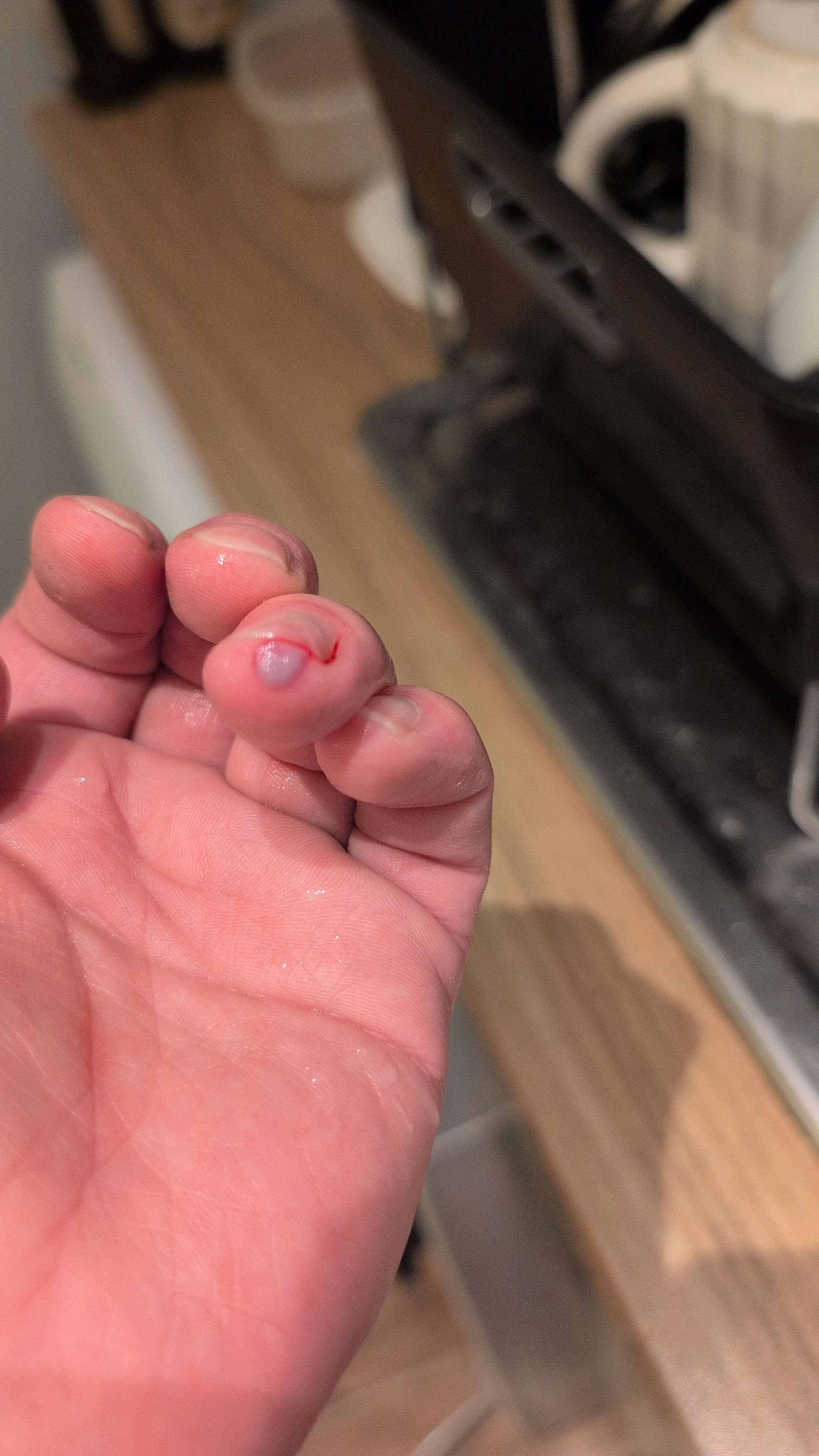 Manged to trap my finger opening a gate, color looks cool