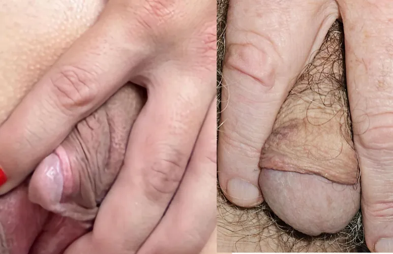 CompetitiveArtist715 Clit and My Little Hypo Penis