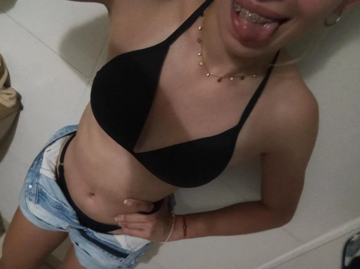 Do my braces make me ugly? f18