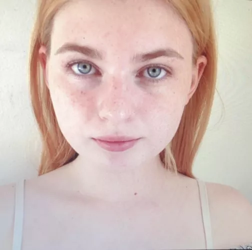 My friends dad said I looked too pale… does he not understand that I’m ginger??