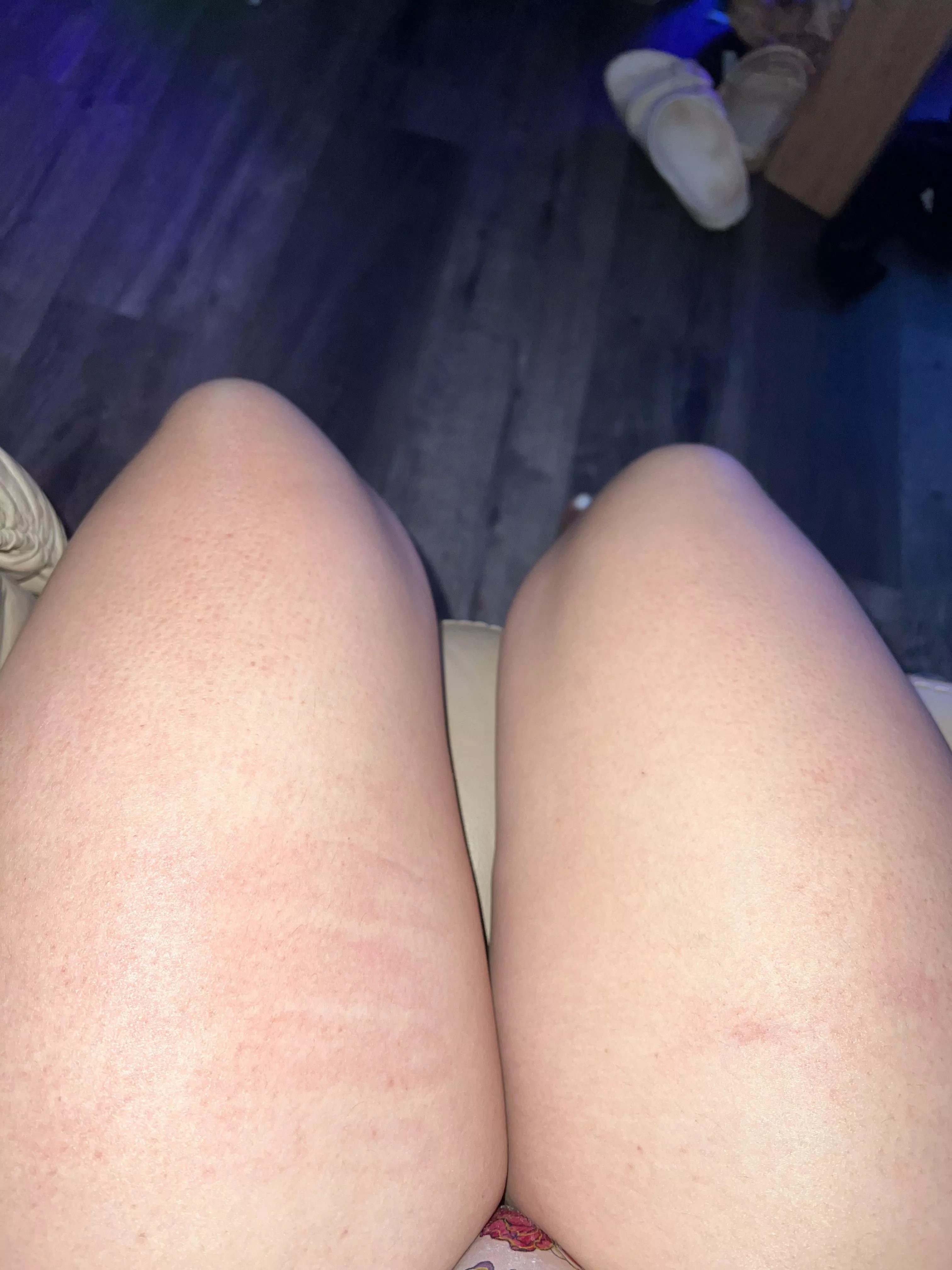 Slapped things!! 😍