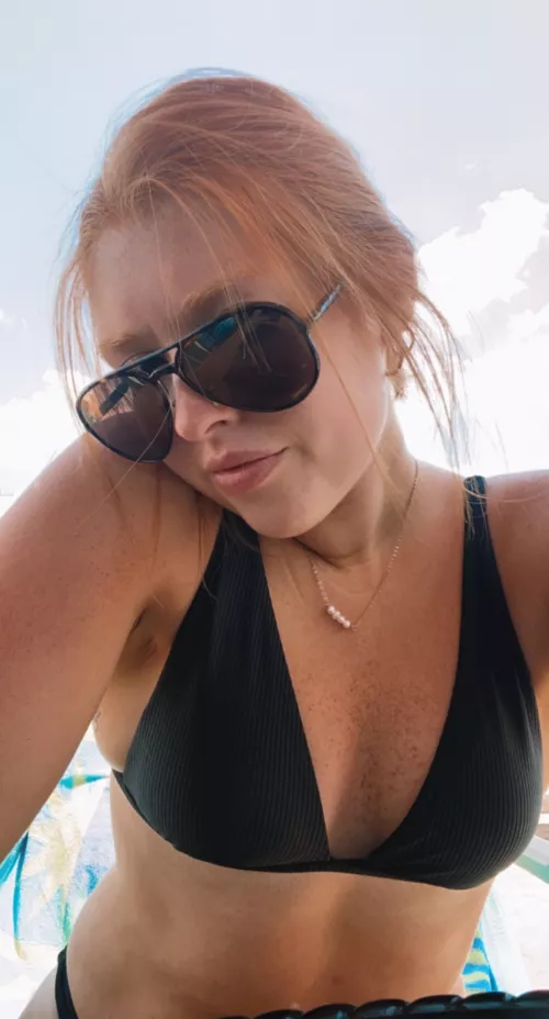 Freckles