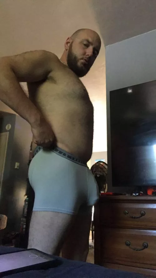 Fat Bulge